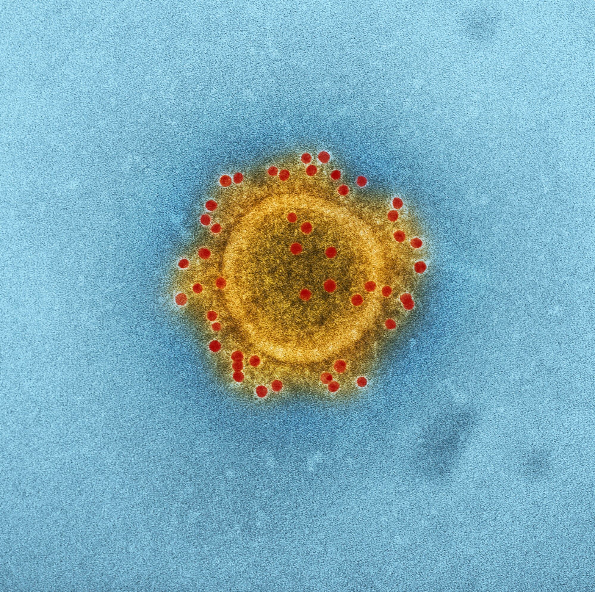 Live Blogging the Coronavirus Outbreak from Ashland, Oregon: The First Days
